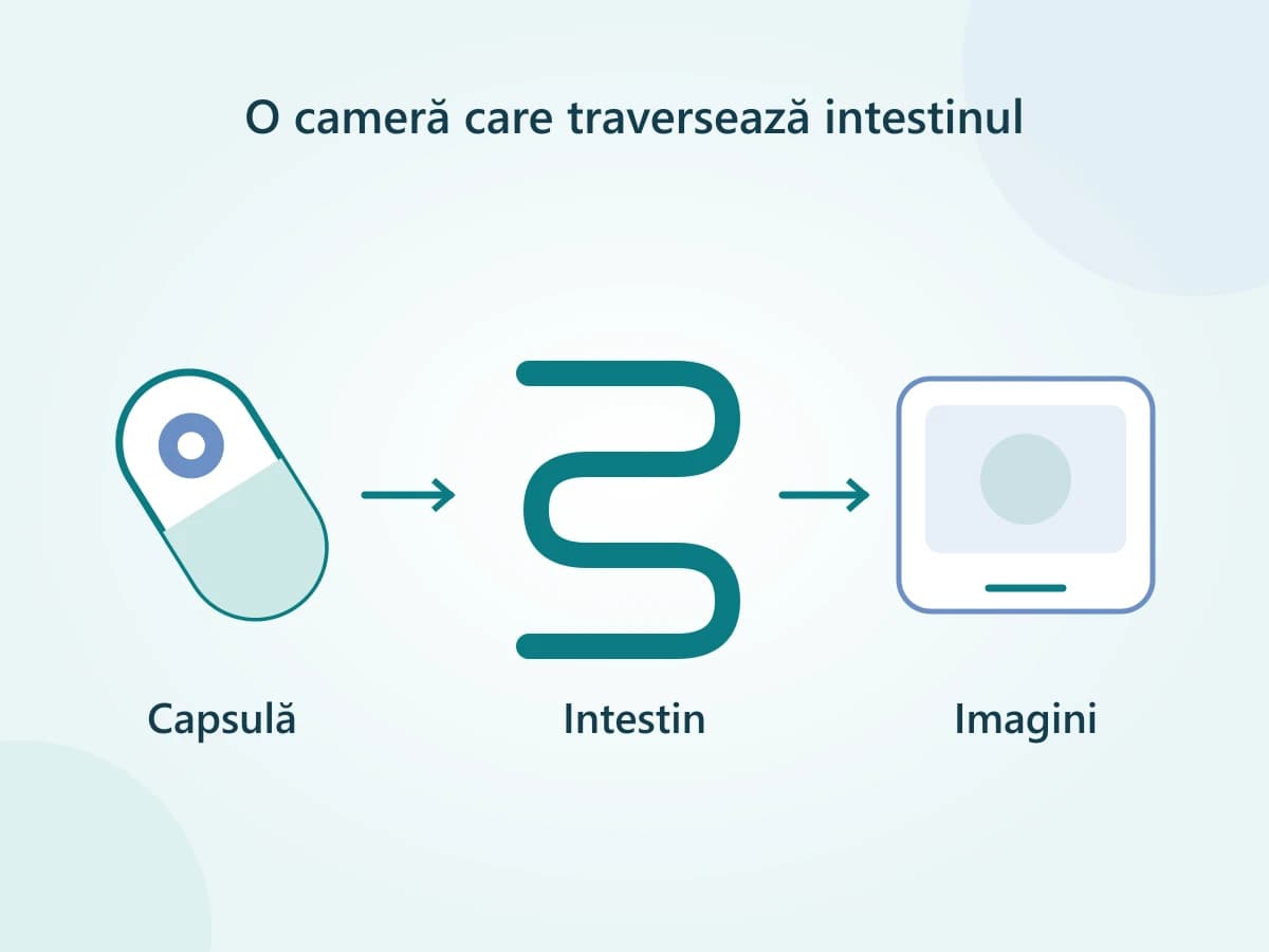 Capsulă cu cameră, imagini ale intestinului și un instrument separat pentru biopsie.