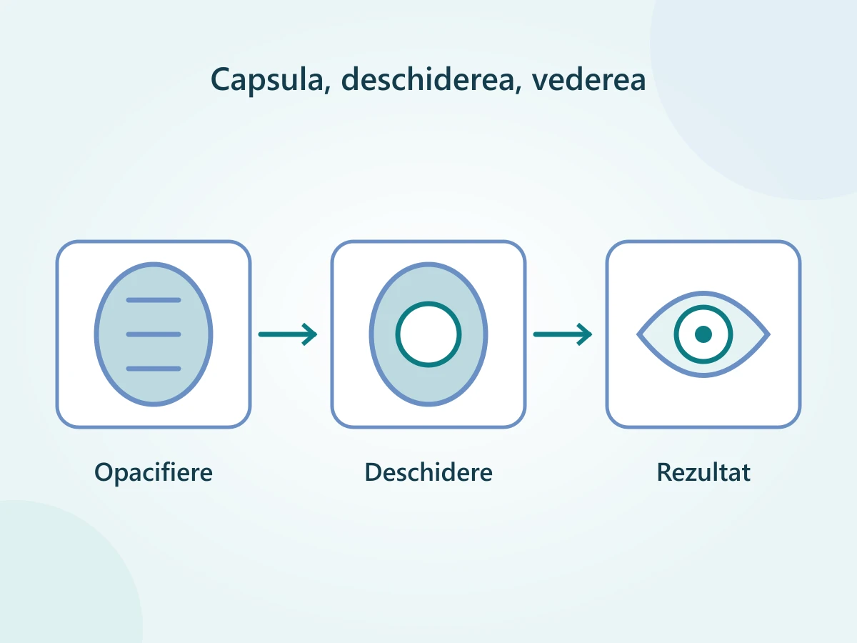 Capsula devine tulbure, laserul creează o deschidere centrală, iar rezultatul depinde și de sănătatea ochiului.