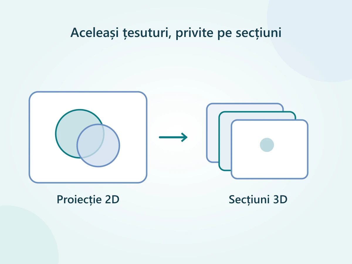 Comparație schematică între țesuturi suprapuse într-o imagine 2D și secțiuni reconstruite prin tomosinteză.